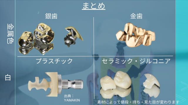 詰め物・被せ物の主な種類