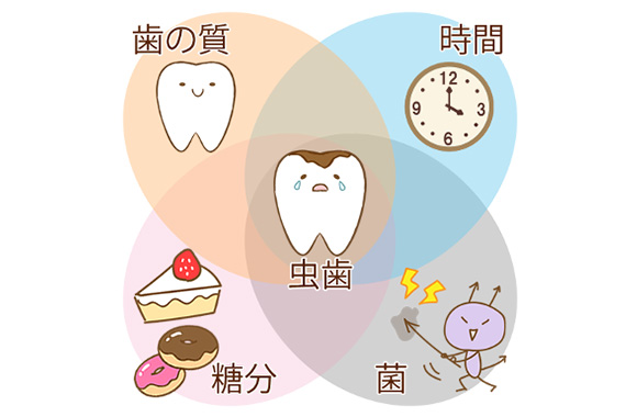 むし歯の原因