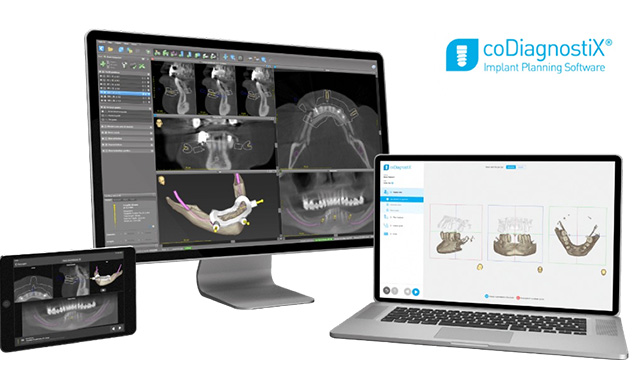 インプラントシプランニングソフト coDiagnostiX