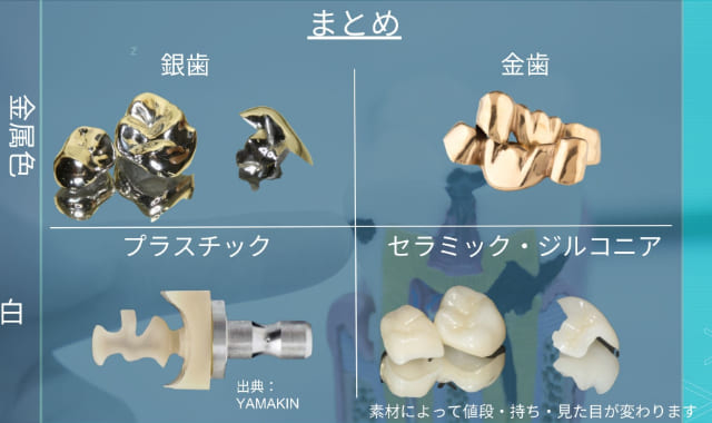 詰め物・被せ物の種類