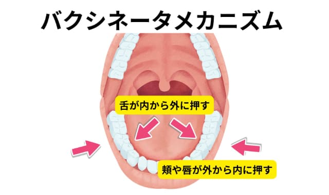 バクシネータメカニズム